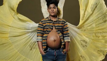 ಗರ್ಭಿಣಿಯಾದ ಹುಡುಗ, ಮಾರ್ಚ್‌ನಲ್ಲಿ ಮಗುವಿಗೆ ಜನ್ಮ, ತೃತೀಯಲಿಂಗಿ ದಂಪತಿಗಳ ವಿಶಿಷ್ಟ ಕಥೆ!