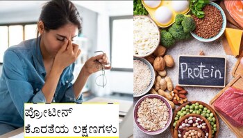 Protein Deficiency: ಅಪ್ಪಿತಪ್ಪಿಯೂ ದೇಹದಲ್ಲಿ ಪ್ರೋಟೀನ್ ಕೊರತೆ ಆಗದಂತೆ ನೋಡಿಕೊಳ್ಳಿ