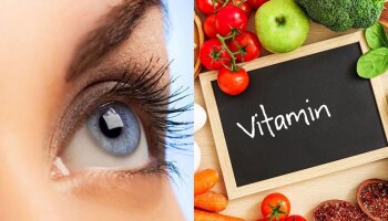 Vitamin Deficiency: ಈ ವಿಟಮಿನ್ ಕೊರತೆ ಕಣ್ಣಿನ ದೃಷ್ಟಿ ದೋಷಕ್ಕೆ ಕಾರಣ 