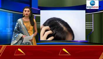 HAIRFALL HEALTH TIPS 