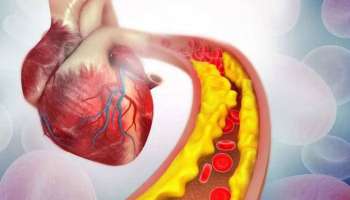  Cholesterol control : ʼಕೊಲೆಸ್ಟ್ರಾಲ್ʼ ಹೆಚ್ಚುತ್ತಿದೆಯೇ? ಈ ಸೂಪರ್ ಫುಡ್ ಗಳಿಂದ ಕೊಬ್ಬು ಕರಗಿಸಿ..!