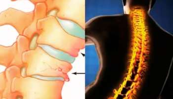 Bones Health: ಆರೋಗ್ಯಕರ ಮೂಳೆಗಳನ್ನು ಪಡೆಯಲು ನಿಮ್ಮ ಡಯಟ್ನಲ್ಲಿರಲಿ ಈ  ಸೂಪರ್‌ಫುಡ್‌ಗಳು