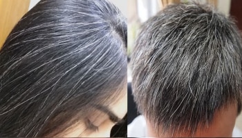 White Hair Problem: ಡೈ ಬಳಸದೆಯೇ ಈ ರೀತಿ ನಿಮ್ಮ ತಲೆಕೂದಲನ್ನು ಕಪ್ಪಾಗಿಸಿ!