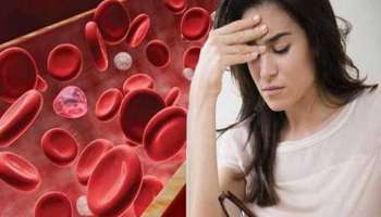 Anemia Problem: ರಕ್ತಹೀನತೆ ಸಮಸ್ಯೆಯಿಂದ ಬಳಲುತ್ತಿದ್ದರೇ ಈ ಆಹಾರಗಳನ್ನು ಸೇವಿಸಿ..!