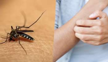 Mosquito Bites: ಮಳೆಗಾಲದಲ್ಲಿ ರಕ್ತ ಹೀರುವ ʼಸೊಳ್ಳೆʼ ಕಾಟಕ್ಕೆ ಇಲ್ಲಿದೆ ನೈಸರ್ಗಿಕ ಪರಿಹಾರ..!