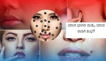 Moles Astrology: ಯಾವ ಭಾಗದ ಮಚ್ಚೆ ಯಾವ ರಾಶಿಗೆ ಶುಭದಾಯಕ?