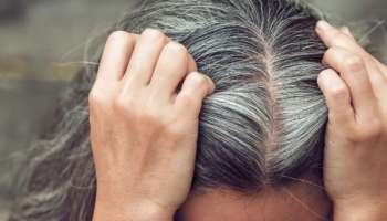 ಕೂದಲು ಬಿಳಿಯಾಗಲು ಇದೇ ಪ್ರಮುಖ ಕಾರಣ ! ಈ ವಿಟಮಿನ್ ಕೊರತೆ ನೀಗಿಸಿದರೆ ಸಾಕು ಬೇರೆ ಇನ್ನೇನೂ ಬೇಡ ! 