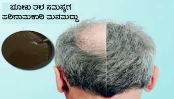 ಈ ಒಂದು ಉಪಾಯ ಮಾಡಿ ನೋಡಿ ಬೋಳು ತಲೆಯಲ್ಲಿಯೂ ಕೂದಲು ಬೆಳೆಯುತ್ತವೆ!