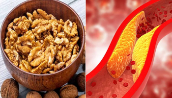 Bad Cholesterol Tips: ಈ ಡ್ರೈಫ್ರೂಟ್ ಅನ್ನು ಈ ರೀತಿ ಸೇವಿಸಿದರೆ, ರಕ್ತ ನಾಳಗಳಲ್ಲಿನ ಕೆಟ್ಟ ಕೊಲೆಸ್ಟ್ರಾಲ್ ಮಂಗಮಾಯ ಗ್ಯಾರಂಟಿ!