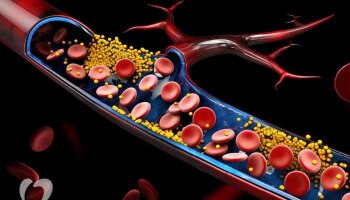 Cholesterol Control Tips: ಮನೆಯ ತರಕಾರಿಯಲ್ಲಿ ಸಾಮಾನ್ಯವಾಗಿ ಕಂಡು ಬರುವ ಈ ಪದಾರ್ಥಗಳಿಂದ ಕೆಟ್ಟ ಕೊಲೆಸ್ಟ್ರಾಲ್ ನಿಯಂತ್ರಿಸಬಹುದು!