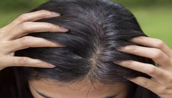 Gray Hair Home Remedies: ತೆಂಗಿನೆಣ್ಣೆಯಲ್ಲಿ ಈ ಎರಡು ಪದಾರ್ಥ ಬೆರೆಸಿ ತಲೆಗೆ ಹಚ್ಚಿ, ಕ್ರಮೇಣ ಬಿಳಿ ಕೂದಲು ಕಪ್ಪಾಗುತ್ತವೆ!