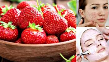 Strawberry Remedy: ಈ ಹಣ್ಣು ಚಳಿಗಾಲದಲ್ಲಿ ಚರ್ಮಕ್ಕೆ ರಾಮಬಾಣ..!ಮೊಂಡುತನದ ಮೊಡವೆಗಳಿಗೆ ಮುಕ್ತಿ