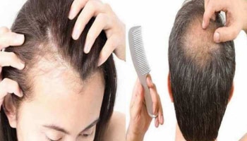 Hair Fall Tips: ಈ ಹಸಿರು ತರಕಾರಿ ನಿಮ್ಮ ಕೂದಲುದುರುವ ಸಮಸ್ಯೆಗೆ ರಾಮಬಾಣ ಉಪಾಯ!