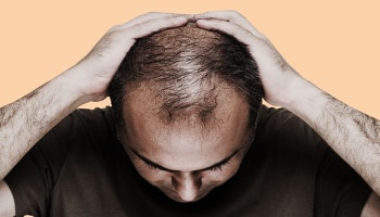 Hair Fall Home Remedy: ಕೂದಲು ಉದುರುವ ಸಮಸ್ಯೆ ನಿವಾರಣೆಗೆ ಈ ರೀತಿಯಾಗಿ ಶಾಂಪೂ ಬಳಸಿ!