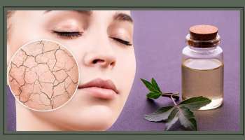 Skin Care: ಕಲೆಗಳಿಲ್ಲದೆ ಹೊಳೆಯುವ ಚರ್ಮಕ್ಕಾಗಿ ಈ ಎಣ್ಣೆ ಸಾಕು..! 