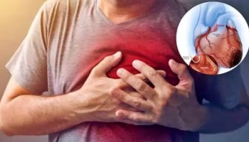 Heart Disease: ಹೃದ್ರೋಗವನ್ನು ತಡೆಗಟ್ಟಲು ಈ ಸರಳ ಸಲಹೆಗಳನ್ನು ಪಾಲಿಸಿ