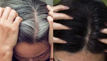 Gray Hair Home Remedies: ಚಿಕ್ಕ ವಯಸ್ಸಿನಲ್ಲಿಯೇ ಕೂದಲು ಬಿಳಿ ಬಣ್ಣಕ್ಕೆ ತಿರುಗುತ್ತಿವೆಯಾ?ಆಹಾರದಲ್ಲಿರಲಿ ಈ 4 ಪದಾರ್ಥಗಳು!