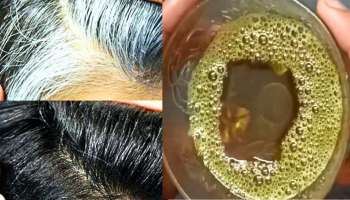 Gray Hair Problem: ಚಿಕ್ಕ ವಯಸ್ಸಿನಲ್ಲಿ ತುಂಬಾ ಬೂದು  ಕೂದಲಿವೆಯೇ ? ಈ ವಿಶೇಷ ಎಣ್ಣೆಯನ್ನು ಬಳಸಿ