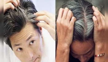 White Hair Remedy: ಕೂದಲು ಈ 3 ಕಾರಣಗಳಿಂದ ಬಿಳಿಯಾಗುತ್ತವೆ, ನೈಸರ್ಗಿಕವಾಗಿ ಹೇಗೆ ಸರಿಪಡಿಸಬೇಕು ಇಲ್ಲಿ ತಿಳಿಯಿರಿ!