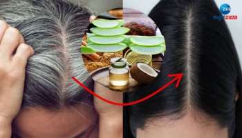 White Hair Remedies: ಕೇವಲ ಈ 3 ಪದಾರ್ಥಗಳನ್ನು ಬಳಸಿ ಬಿಳಿ ಕೂದಲಿಗೆ ಹೇಳಿ ಗುಡ್ ಬೈ!