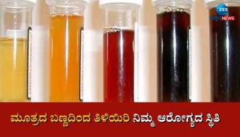 Urine Colours: ಮೂತ್ರದ ಬಣ್ಣದಿಂದ ತಿಳಿಯಿರಿ ನಿಮ್ಮ ಆರೋಗ್ಯದ ಸ್ಥಿತಿ 