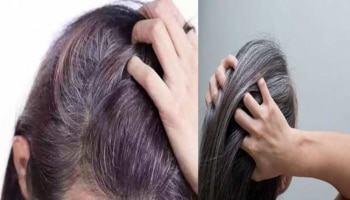 Black Hair Remedies: ತೆಂಗಿನೆಣ್ಣೆಯಲ್ಲಿ ಈ ಒಂದು ಪದಾರ್ಥ ಬೆರೆಸಿ ತಲೆಗೆ ಹಚ್ಚಿ, ಕೆಲವೇ ದಿನಗಳಲ್ಲಿ ಕಪ್ಪಾಗುತ್ತವೆ ಬಿಳಿ ಕೂದಲು!