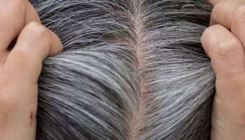 White Hair Remedy : ಏನನ್ನೂ ಹಚ್ಚಬೇಕೆಂದಿಲ್ಲ, ಈ ಪದಾರ್ಥಗಳನ್ನು ಸೇವಿಸಿದರೆ ಸಾಕು ಬಿಳಿ ಕೂದಲು ಕಪ್ಪಾಗಲು 