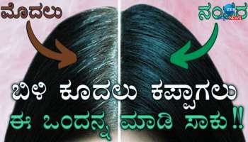 White Hair Remedy: ಬಿಳಿ ಕೂದಲನ್ನು ನೈಸರ್ಗಿಕವಾಗಿ ಕಪ್ಪಾಗಿಸಲು ತುಂಬಾ ಲಾಭದಾಯಕ ಈ 4 ಪದಾರ್ಥ 