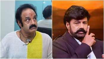 Balakrishna wig : ಬಾಲಯ್ಯ ಹಾಕುವ ʼವಿಗ್‌ʼ ಮುಟ್ಟಿದ್ರೆ..! ಖ್ಯಾತ ನಿರ್ದೇಶಕನ ಶಾಕಿಂಗ್‌ ಹೇಳಿಕೆ