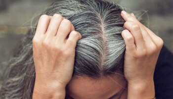 White Hair Home Remedies: ಯಾವುದೇ ರೀತಿಯ ಬಣ್ಣ ಬಳಸದೆ ಬಿಳಿ ಕೂದಲು ಕಪ್ಪಾಗಿಸಬೇಕೆ? ಈ ಲೇಖನ ಓದಿ!