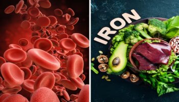 Iron Deficiency  Remedy : ದೇಹದಲ್ಲಿ ಕೆಂಪು ರಕ್ತ ಕಣಗಳ ಕೊರತೆಯಿದ್ದರೆ  ಈ ಐದು ಆಹಾರಗಳನ್ನು ಸೇವಿಸಿದರೆ ಸಾಕು !