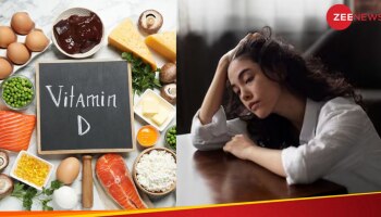 Vitamin D Deficiency: ಮಹಿಳೆಯರು ವಿಟಮಿನ್ ಡಿ ಕೊರತೆ ಹೊಂದಿದ್ದೆ ಆದಲ್ಲಿ...ಈ ರೋಗಗಳ ಅಪಾಯ ಗ್ಯಾರಂಟಿ...!