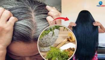 Premature Grey Hair Treatment: ಅಕಾಲಿಕ ಬಿಳಿ ಕೂದಲನ್ನು ಬುಡದಿಂದಲೂ ಕಪ್ಪಾಗಿಸುತ್ತೆ ಈ ಗಿಡಮೂಲಿಕೆಗಳು 