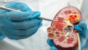 Kidney Disease: ತಿನ್ನಲು ಮನಸ್ಸು ಬರುತ್ತಿಲ್ಲವೇ..? ವೈದ್ಯರಿಂದ ಈ ಕಾರಣ ಕೂಡಲೇ ತಿಳಿದುಕೊಳ್ಳಿ 
