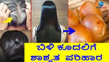 White Hair Remedies: ಬಿಳಿ ಕೂದಲನ್ನು ಶಾಶ್ವತವಾಗಿ ಕಪ್ಪಾಗಿಸಲು ಈರುಳ್ಳಿ ಸಿಪ್ಪೆಯನ್ನು ಈ ರೀತಿ ಬಳಸಿ 