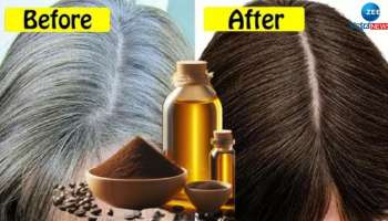 White Hair Remedy: ಬಿಳಿ ಕೂದಲನ್ನು ಶಾಶ್ವತವಾಗಿ ಕಪ್ಪಾಗಿಸಲು ಈ ಮೂರೇ ಮೂರು ವಸ್ತು ಸಾಕು!