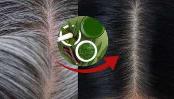 White Hair Remedy: ಅಪ್ಪಿತಪ್ಪಿಯೂ ಬಿಳಿ ಕೂದಲನ್ನು ಕೀಳಬೇಡಿ.. ಈ ಸುಲಭ ಮನೆಮದ್ದನ್ನು ಟ್ರೈ ಮಾಡಿ ಶಾಶ್ವತವಾಗಿ ಕಪ್ಪಾಗುತ್ತೆ!!