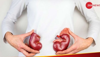 Kidney Problem: ಕಿಡ್ನಿ ಬಗ್ಗೆ ಕಾಳಜಿ ವಹಿಸದಿದ್ದರೆ ನಿಮ್ಮ ಪ್ರಾಣವೇ ಹೋಗುತ್ತೆ..! 