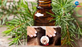 Hair Care: ಕೂದಲಿನ ಹಲವು ಸಮಸ್ಯೆಗಳಿಗೆ ಈ ಎಣ್ಣೆಯೊಂದೇ ಪರಿಹಾರ 