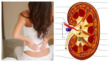 ಕಿಡ್ನಿ ಆರೋಗ್ಯದಲ್ಲಿ ಸ್ವಲ್ಪ ವ್ಯತ್ಯಾಸವಾದರೂ ಬೆಳಗ್ಗೆ ಎದ್ದ ಕೂಡಲೇ  ಕಾಣಿಸುತ್ತದೆ ಈ ಲಕ್ಷಣಗಳು!ಒಮ್ಮೆ ಗಮನಿಸಿ ನೋಡಿ !