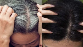 Hair Care Tips: ಬಿಳಿ ಕೂದಲು ಕಪ್ಪಾಗಿಸಲು ಪವರ್‌ಫುಲ್‌ ಮನೆಮದ್ದುಗಳು