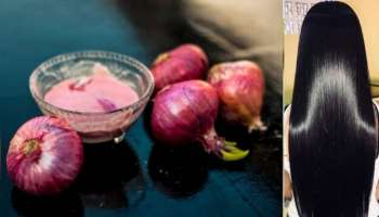 ಬಿಳಿ ಕೂದಲನ್ನು ಬುಡದಿಂದಲೂ ಕಪ್ಪಾಗಿಸುತ್ತೆ ಈರುಳ್ಳಿ, ಜಸ್ಟ್ ಹೀಗೆ ಬಳಸಿ..! 