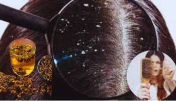 ಮಸಾಲೆ ಡಬ್ಬಿಯಲ್ಲಿರುವ ಲವಂಗದ ನೀರು ಕುಡಿಯುವುದರಿಂದ ಕೂದಲಿಗೆ ಸಿಗುತ್ತೆ  5 ಪ್ರಮುಖ ಪ್ರಯೋಜನಗಳು 