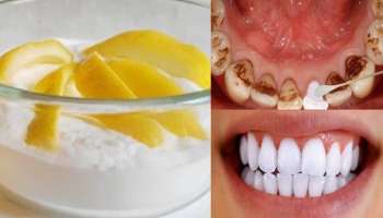 ಈ ಹಣ್ಣಿನ ಸಿಪ್ಪೆಯಲ್ಲಿ ಹಲ್ಲುಜ್ಜಿದರೆ 2 ನಿಮಿಷದಲ್ಲಿ ಹಲ್ಲಿನಲ್ಲಿ ಅಂಟಿರುವ ಹಳದಿ ಕಲೆ ಶಾಶ್ವತವಾಗಿ ತೊಲಗುವುದು! ವಯಸ್ಸು 80 ದಾಟಿದ್ರೂ ಹುಳುಕಾಗಲ್ಲ