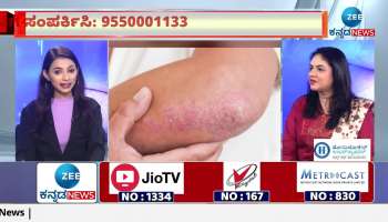 Don't worry if you have psoriasis.. here is the solution