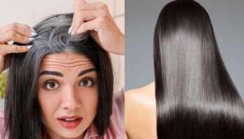 ದುಬಾರಿ ಹೇರ್ ಪ್ರಾಡಕ್ಟ್ ಬೇಡ... ಅಕ್ಕಿ, ಈರುಳ್ಳಿಯಿಂದ ಬಿಳಿ ಕೂದಲನ್ನು ಶಾಶ್ವತವಾಗಿ ಕಪ್ಪಾಗಿಸಿ 