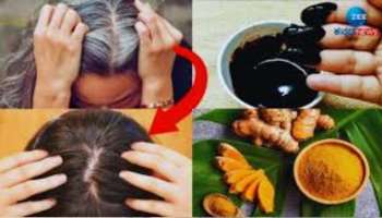 ಹೇರ್ ಡೈ, ಹೆನ್ನಾ ಬೇಡ.... ಅರಿಶಿನ, ಆಮ್ಲಾ ಪುಡಿಯಿಂದ ಶಾಶ್ವತವಾಗಿ ಕಪ್ಪಾಗುತ್ತೆ ಬಿಳಿ ಕೂದಲು..! 