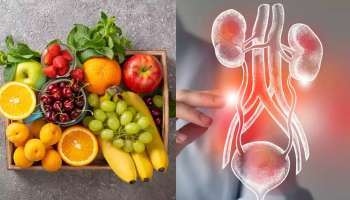 ಈ ರಸಭರಿತ ಹಣ್ಣನ್ನು ವಾರಕ್ಕೊಮ್ಮೆ ತಿಂದರೆ ಕಿಡ್ನಿ ಫುಲ್‌ ಕ್ಲೀನ್‌ ಆಗುತ್ತೆ! ಮೂತ್ರಕೋಶದ ಸಮಸ್ಯೆ ಜನ್ಮಕ್ಕೆ ಬರಲ್ಲ 