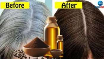 ಹರಳೆಣ್ಣೆಯಲ್ಲಿ ಈ ಶಾಂಪೂ ಮಿಶ್ರಣ ಬೆರೆಸಿ ಹಚ್ಚಿ, ಬಿಳಿ ಕೂದಲು ಕಪ್ಪಾಗುವುದರಲ್ಲಿ ಅನುಮಾನವೇ ಬೇಡ... 