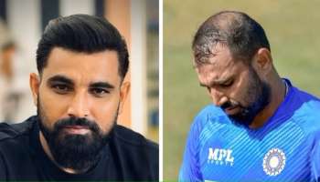 ಕೇವಲ ಈ ಟಿಪ್ಸ್‌ ಫಾಲೋ ಮಾಡಿ... 34ರ ವಯಸ್ಸಲ್ಲೂ ಬೋಳು ತಲೆಯಲ್ಲಿ ದಷ್ಟಪುಷ್ಟ ಕಡುಕಪ್ಪಾದ ಕೂದಲು ಬೆಳೆಸಿಕೊಂಡ ಕ್ರಿಕೆಟಿಗ ಮೊಹಮ್ಮದ್‌ ಶಮಿ
